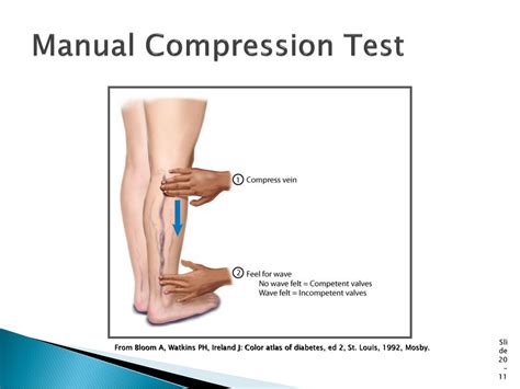 venous manual compression test|Manual Compression .